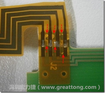 這張圖所顯示的,PCBA工廠實際進(jìn)行HotBar(熱壓熔錫焊接)焊接的時候,經(jīng)常會出現(xiàn)這類焊墊之間短路的問題,下面的圖示為比較嚴(yán)重的案例,大部分都只有部份溢錫,但這對品質(zhì)信賴杜已經(jīng)產(chǎn)生了及大的為害,既使現(xiàn)在測試沒有出現(xiàn)問題,難保在高溫膏濕的環(huán)境下不會出現(xiàn)電子遷移(Electromigration)的現(xiàn)象。